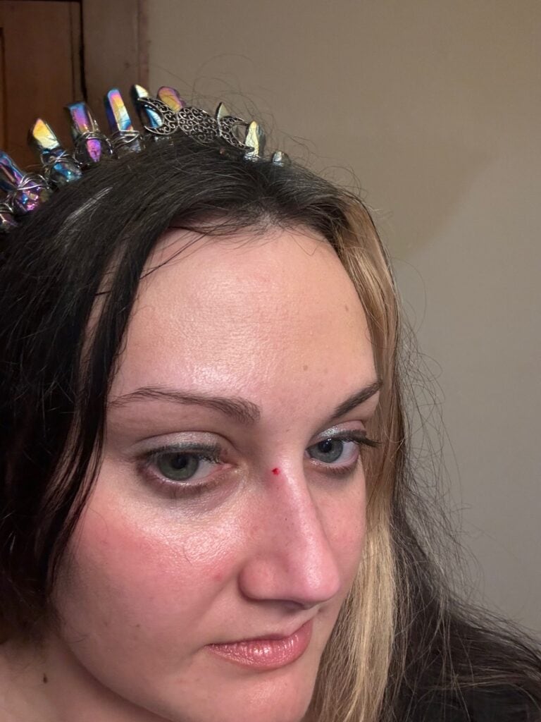 woman with cut on nose from being hit in the face with Mardi Gras beads at a parade